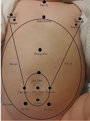 Zonas y puntos del tórax y abdomen usados en Tui-Na infantil